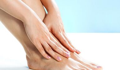 Varices of the lower limbs