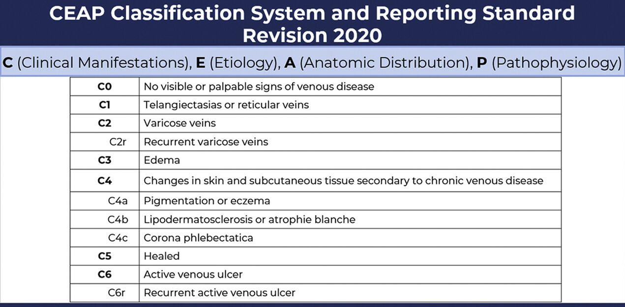 Stages of varicose veins according to the CEAP classification modified in 2020