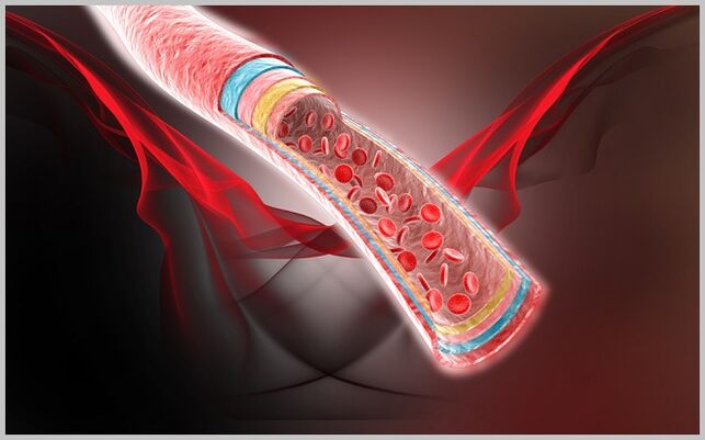 blood flow in the veins after treatment of varicose veins with gel